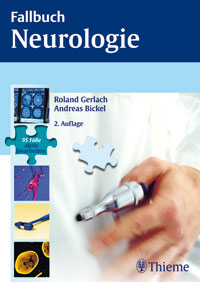 Fallbuch Neurologie