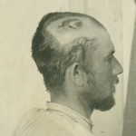 Kopf-mitte